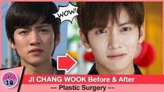 💬 Ji Chang Wook Before and After Plastic Surgery NETIZEN BUZZ [upl. by Nnylsaj]