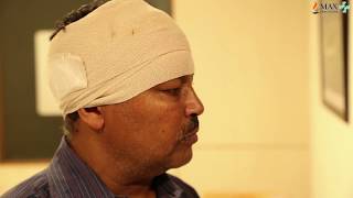 Meningioma Treatment Brain Tumor Surgery For Skull Base Tumor  Max Hospital [upl. by Akinaj86]