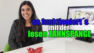 so funktioniert´s mit der losen ZAHNSPANGE  Orthodentix [upl. by Oizirbaf]