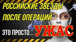 Российские звезды после пластических операций  это ШОК [upl. by Ravaj]