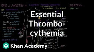 What is essential thrombocythemia  Hematologic System Diseases  NCLEXRN  Khan Academy [upl. by Lothario584]