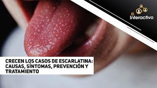 Crecen los casos de escarlatina causas síntomas prevención y tratamiento [upl. by Andri]