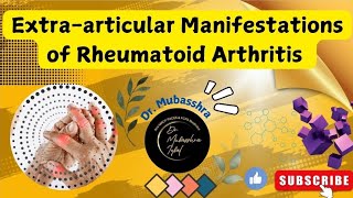 Extraarticular Manifestations of Rheumatoid Arthritis  All you need to know DrMubasshra [upl. by Odrahcir]