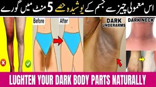 Lighten Dark Underarms Urgently  Skin Bleaching At Home  Dark Privat Area Whitening [upl. by Noelani]