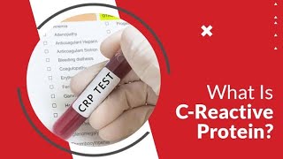 What is CRP TEST Dr Health Officials [upl. by Krantz]