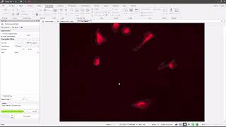 ImagePro v11 Cell Biology Protocols  Lipid Droplets [upl. by Aitas]