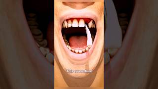 Teeth experiment  facts mine  teeth doctor [upl. by Ebehp]