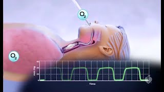 Capnography Made Easy [upl. by Ralf576]