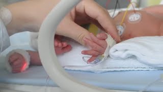 Bubble CPAP for Increased Lung Function in Premature Babies with Hany Aly MD [upl. by Bradeord]