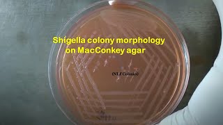 Shigella colony morphology on MacConkey agar [upl. by Akisej]