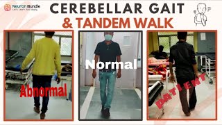 Cerebellar Ataxia Gait Abnormal TandemWalk neurology widebasegait tandemgait meded [upl. by Fanni]