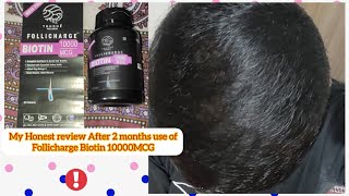 follicharge Biotin 10000mcg Review After use of 2 month Result [upl. by Akinit]