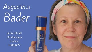 Using Augustinus Bader On Half My Face For 12 Months  Did It Help [upl. by Rotkiv]