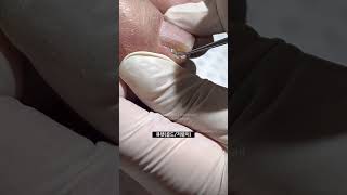 발톱정리정리만 진행 쾌감 영상 드릴케어efile pedicure ※ 모델분 기술자가 상처받을만한 댓글 강제 삭제함 [upl. by Ibbob]