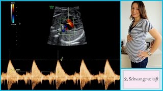 Schwangerschaftsupdate 22 Woche  Organultraschall  gabelschereblog [upl. by Oisor]