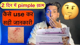 Clinsol gel 2 दिन में pimple  Clinsol gel kaise lagaye  Clinsol gel review  clinsol gel  clinsol [upl. by Leatri]