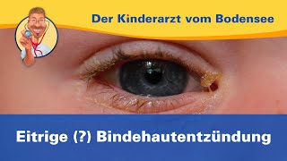 Eitrige  Bindehautentzündung — Der Kinderarzt vom Bodensee [upl. by Litta]