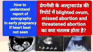 blighted ovum Incomplete or missed abortion का ultrasound रिपोर्ट मे क्या मतलब होता है [upl. by Eniretak]