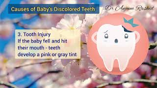 Baby Teeth Discolored  Causes amp Solution  Newborn Caring Tips [upl. by Verdha]