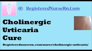 Cholinergic Urticaria Cure [upl. by Nedroj]