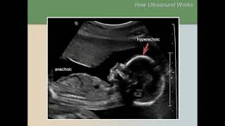 Ultrasound Training Course 02 part 1 [upl. by Aynatahs]