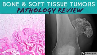 Bone amp Soft Tissue Pathology Board Review 21 Classic Cases [upl. by Chappelka]