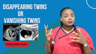 VANISHING TWINS SYNDROME What happens and what can be done [upl. by Niowtna]