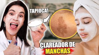 Use TAPIOCA para Clarear as Manchas de Pele [upl. by Dessma]