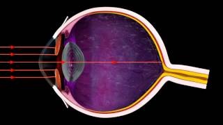 How the Iris Controls Light Entering the Eye  3D Medical Animation Eye  ABP © [upl. by Gudrun754]