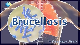 Brucellosis Killing  Energy amp Quantum Medicine  Healing Frequency  Raise Vibrations [upl. by Ettelrats]