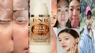 BNB Rice Extract Cream  Honest Review [upl. by Yarrum109]