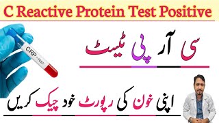 C Reactive Protein Blood Test Urdu Hindi  CRP Blood Test  CRP Test Normal Levels  Irfan Azeem [upl. by Qooraf]