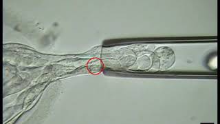 IVF  Embryo Biopsy Procedure Tests Embryos For Genetic Abnormalities [upl. by Eemla797]