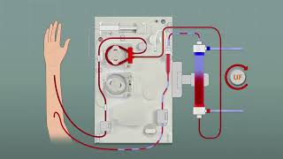 Let’s learn Surdial X Training Series  How does the Dialysate Infusion Function DIF work [upl. by Meara]