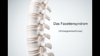 Facettensyndrom 2 Übungen gegen Rückenschmerzen [upl. by Anirahs]