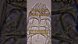 It Lives On Your Face Demode Face Mites microscope shorts science microbiology demodex mites [upl. by Airetnuhs]