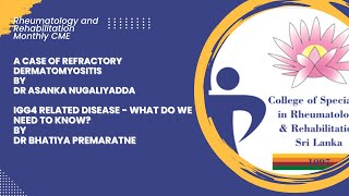 Refractory Dermatomyositis by Dr Asanka Nugaliyadda  IgG4 Related Disease by Dr Bhatiya Premaratne [upl. by Assila]