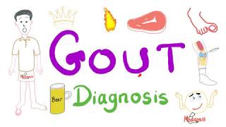 Gout Diagnosis [upl. by Guibert]