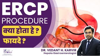 ERCP क्या होता है ERCP कब कराना जरूरी है  पित्त की नली में पथरी  Dr Vedant Karvir [upl. by Otsuj]