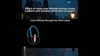 Which of these colour MMode tracings shows a patient with bileaflet mitral valve prolapse 🤔 [upl. by Ninette]