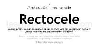 Rectocele pronunciation and definition [upl. by Namra131]