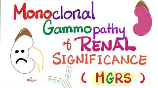 Monoclonal Gammopathy of Renal Significance MGRS  Plasma Cell Disorder  Hematology  Oncology [upl. by Eyk]