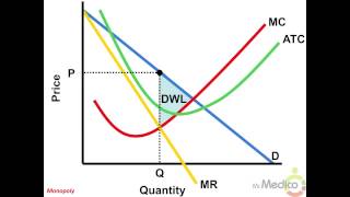 Monopoly  What You Must Know in 5 Minutes  Microeconomics [upl. by Eentruoc423]