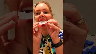 opalescence 16 carbamide peroxide professional home teeth whitening how to use guide by a dentist [upl. by Sande]