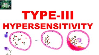 Type III Hypersensitivity  Immune complex mediated Hypersensitivity  Mechanism  Examples [upl. by Mallis840]