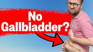 Keto and Gallbladders the SECRET no one knows [upl. by Goeger527]