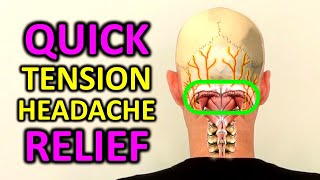 Tension Headache Exercises Stress Headache Relief in 4 Minutes [upl. by Anahsit]