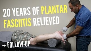 20 Years of Plantar Fasciitis RELIEVED With ASTR FOLLOWUP [upl. by Hagi790]