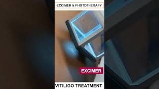 Phototherapy Excimer The Future of Vitiligo Treatment  Care Well Medical Centre shorts [upl. by Zerat171]