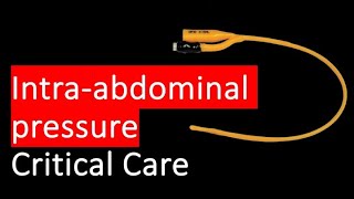 HOW and WHY do we measure intra abdominal pressure [upl. by Alberik]